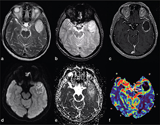 Fig 13